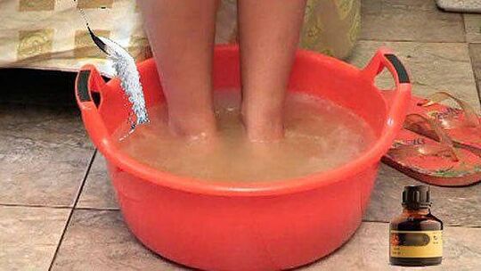 Taking a warm bath with iodine is one of the stages in the treatment of toenail fungus