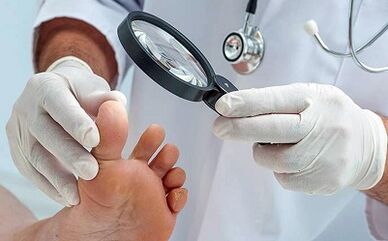 How to get rid of your nails