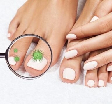 Nail infection through throbbing