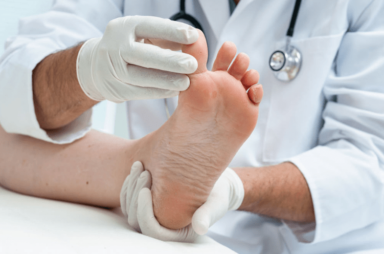 Healing nail fungus
