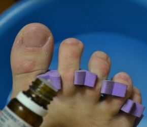 Preparation for treating nails with anti-fungal drops